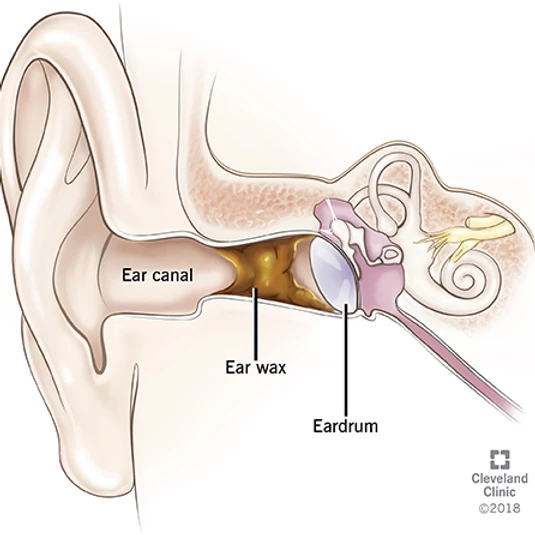 Ew, Earwax!