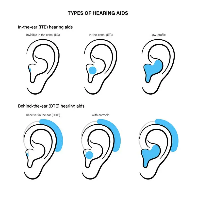Featured image for “How to Choose a Hearing Aid”